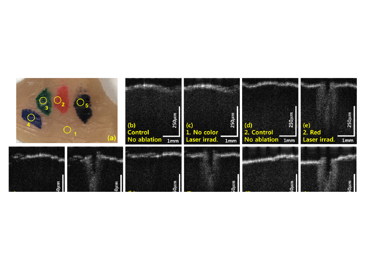 Key figure for **Hang Chan Jo**, Dong Jun Shin, Jin-Chul Ahn, Phil-Sang Chung, **Dae Yu Kim**In Vivo Monitoring ...