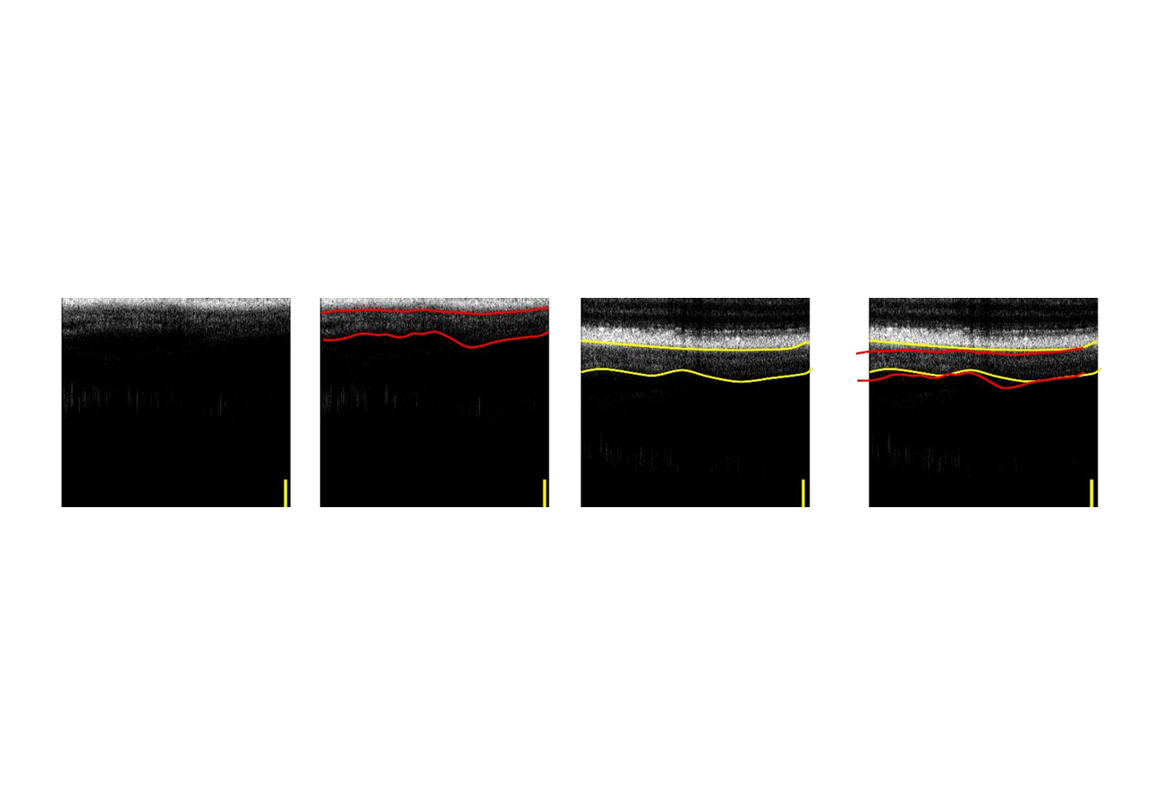 Key figure for **Hang Chan Jo**, Jae Hun Kim, **Dae Yu Kim**In Vivo Observing Effects of the Microgravity Enviro...